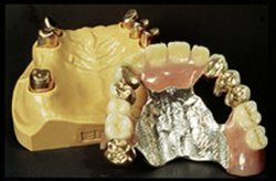Combined dentures=