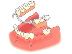 Combined dentures